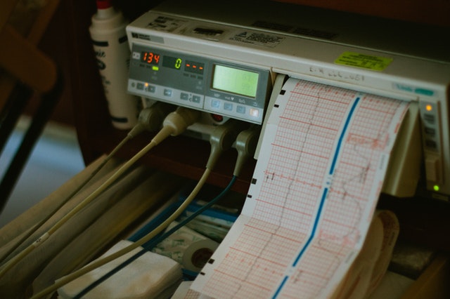 ECG – Conduction issues